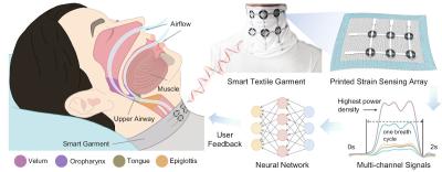 Scientists develop ‘smart pajamas' to monitor sleep disorders image